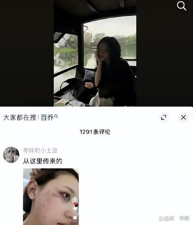 张百乔小雪再传婚变?别墅出售引热议